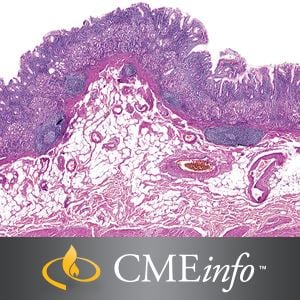 Gastrointestinal Pathology – Masters of Pathology Series 2018 (Videos)
