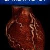 The Complete Guide to Cardiac CT (Original PDF from Publisher)