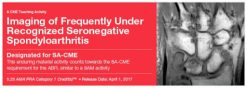 2017 Imaging of Frequently Under Recognized Seronegative Spondyloarthritis (Videos)