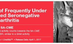 2017 Imaging of Frequently Under Recognized Seronegative Spondyloarthritis (Videos)