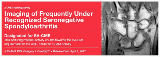 2017 Imaging of Frequently Under Recognized Seronegative Spondyloarthritis (Videos)