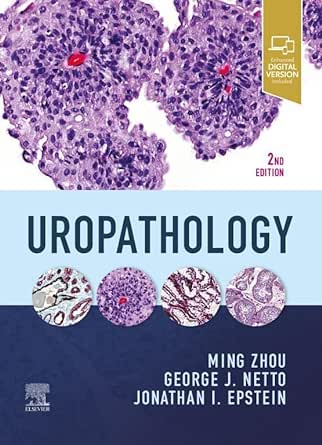 Uropathology, 2nd Edition (EPUB)