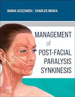 Management of Post-Facial Paralysis Synkinesis (EPUB)