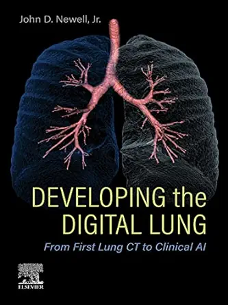 Developing the Digital Lung: From First Lung CT to Clinical AI (EPUB)