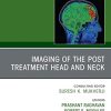 Imaging of the Post Treatment Head and Neck, An Issue of Neuroimaging Clinics of North America, E-Book (Clinics Collections) (Original PDF from Publisher)