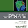Imaging of the Post Treatment Head and Neck, An Issue of Neuroimaging Clinics of North America, E-Book (Clinics Collections) (Original PDF from Publisher)