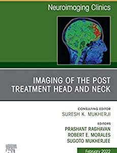 Imaging of the Post Treatment Head and Neck, An Issue of Neuroimaging Clinics of North America, E-Book (Clinics Collections) (Original PDF from Publisher)