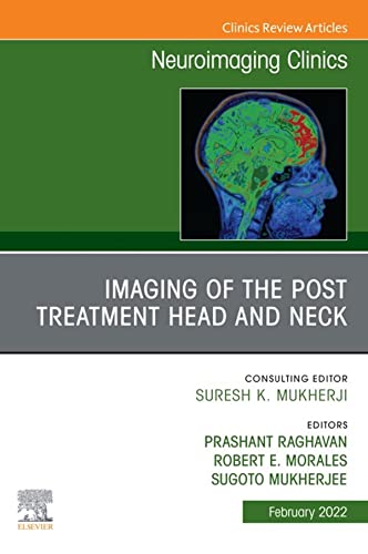 Imaging of the Post Treatment Head and Neck, An Issue of Neuroimaging Clinics of North America, E-Book (Clinics Collections) (Original PDF from Publisher)