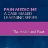The Ankle and Foot: A Volume in the Pain Medicine: A Case Based Learning series (EPUB)