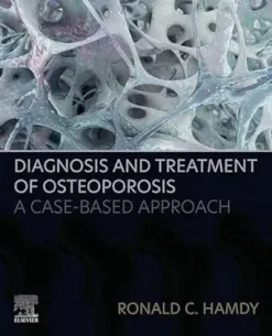Diagnosis and Treatment of Osteoporosis: A Case-Based Approach (EPUB)