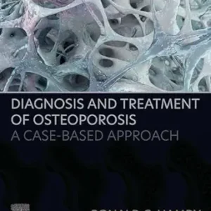 Diagnosis and Treatment of Osteoporosis: A Case-Based Approach (Original PDF from Publisher)