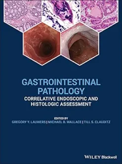 Gastrointestinal Pathology: Correlative Endoscopic and Histologic Assessment (EPUB)