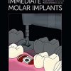 Immediate Molar Implants (Original PDF from Publisher)