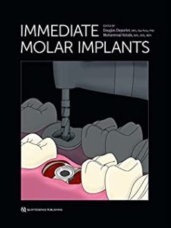 Immediate Molar Implants (Original PDF from Publisher)
