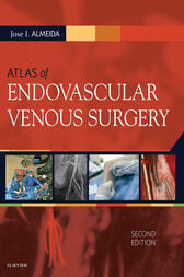 Atlas of Endovascular Venous Surgery, 2nd Edition (Videos, Organized)