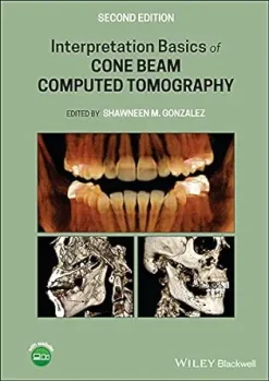 Interpretation Basics of Cone Beam Computed Tomography, 2nd Edition (EPUB)