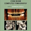 Interpretation Basics of Cone Beam Computed Tomography, 2nd Edition (Original PDF from Publisher)