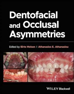 Dentofacial and Occlusal Asymmetries (EPUB)