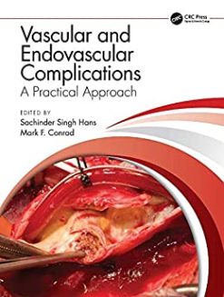 Vascular and Endovascular Complications: A Practical Approach (Original PDF from Publisher)