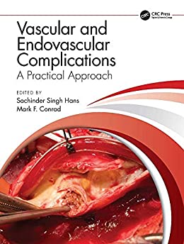 Vascular and Endovascular Complications: A Practical Approach (Original PDF from Publisher)
