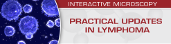 USCAP Practical Updates in Lymphoma 2018 (Videos)