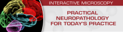USCAP Practical Neuropathology for Today’s Practice – Interactive Microscopy 2019 (Videos)