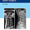 Instrumentation for Minimally Invasive Spine Surgery (Original PDF from Publisher)