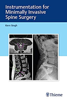 Instrumentation for Minimally Invasive Spine Surgery (Original PDF from Publisher)