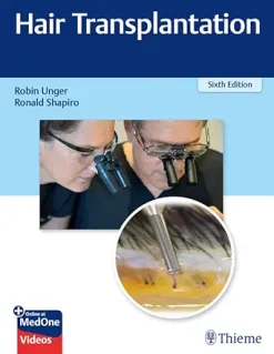 Hair Transplantation, 6th Edition (EPUB)