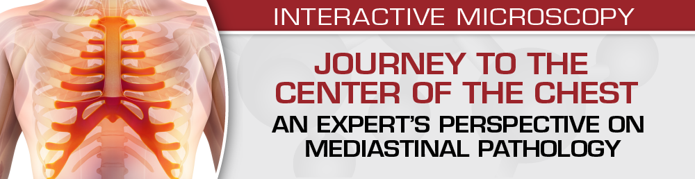 USCAP Journey to the Center of the Chest: An Expert’s Perspective On Mediastinal Pathology 2021 (Videos)