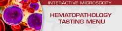 USCAP Hematopathology Tasting Menu: A Sampling of Delightful Diagnostic Challenges 2021 (Videos)