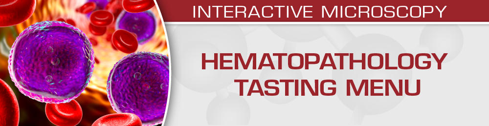 USCAP Hematopathology Tasting Menu: A Sampling of Delightful Diagnostic Challenges 2021 (Videos)