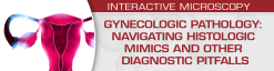USCAP Gynecologic Pathology: Navigating Histologic Mimics and Other Diagnostic Pitfalls 2021 (Videos)