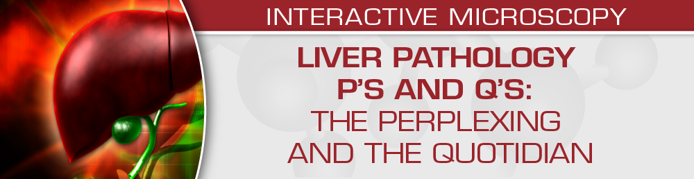 USCAP Liver Pathology P’s and Q’s: The Perplexing and the Quotidian 2022 (Videos)