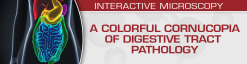 USCAP A Colorful Cornucopia of Digestive Tract Pathology 2022 (Videos)