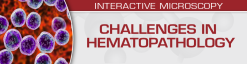 USCAP Challenges in Hematopathology 2022 (Videos)