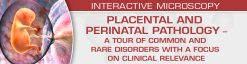 USCAP Placental and Perinatal Pathology A Tour of Common and Rare Disorders with a Focus on Clinical Relevance 2023 (Videos)