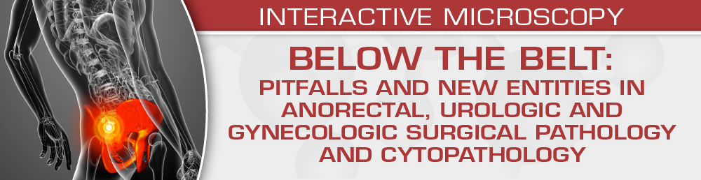 USCAP BELOW THE BELT: Pitfalls and New Entities in Anorectal, Urologic and Gynecologic Surgical Pathology and Cytopathology 2023 (Videos)