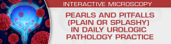 USCAP Pearls and Pitfalls (Plain or Splashy) in Daily Urologic Pathology Practice 2023 (Videos)
