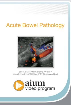 AIUM Point-of-Care Ultrasound Assessment of Acute Bowel Pathology (Videos)