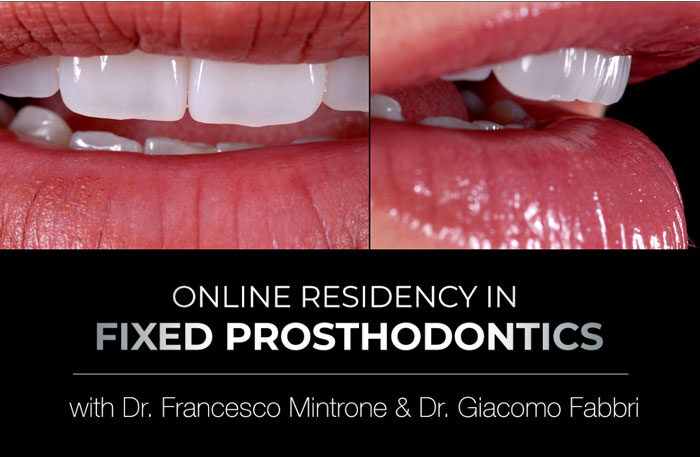 gIDEdental Online Residency Program in Fixed Prosthodontics (Videos)