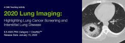 2020 Lung Imaging Highlighting Lung Cancer Screening and Interstitial Lung Disease (Videos)
