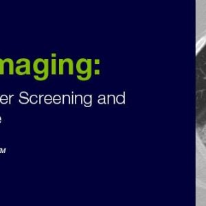 2020 Lung Imaging Highlighting Lung Cancer Screening and Interstitial Lung Disease (Videos)
