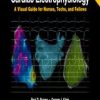 Cardiac Electrophysiology: A Visual Guide for Nurses, Techs, and Fellows, Second Edition (Original PDF from Publisher)
