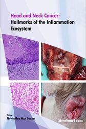 Head and Neck Cancer: Hallmarks of the Inflammation Ecosystem (Original PDF from Publisher)