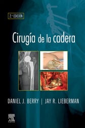 Cirugía de la cadera (2nd ed.) (Original PDF from Publisher)