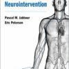 Radial Access for Neurointervention (Original PDF from Publisher)