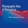 Photographic Atlas of Rhinoplasty (Original PDF from Publisher)