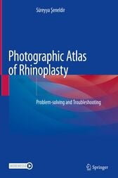 Photographic Atlas of Rhinoplasty (Original PDF from Publisher)