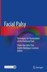 Facial Palsy (Original PDF from Publisher)